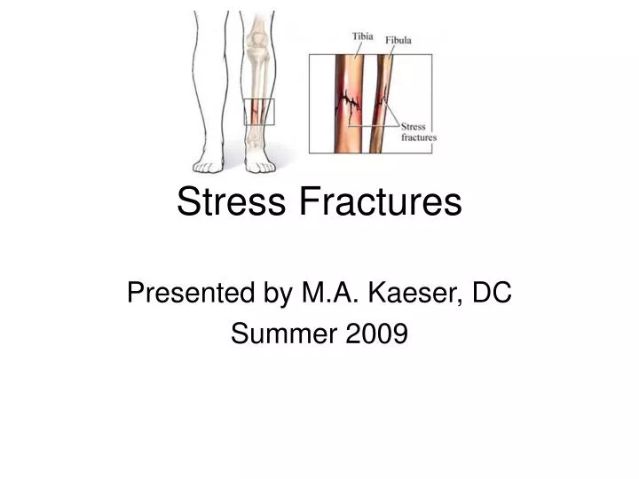 stress fractures