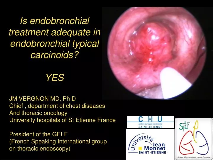 is endobronchial treatment adequate in endobronchial typical carcinoids yes