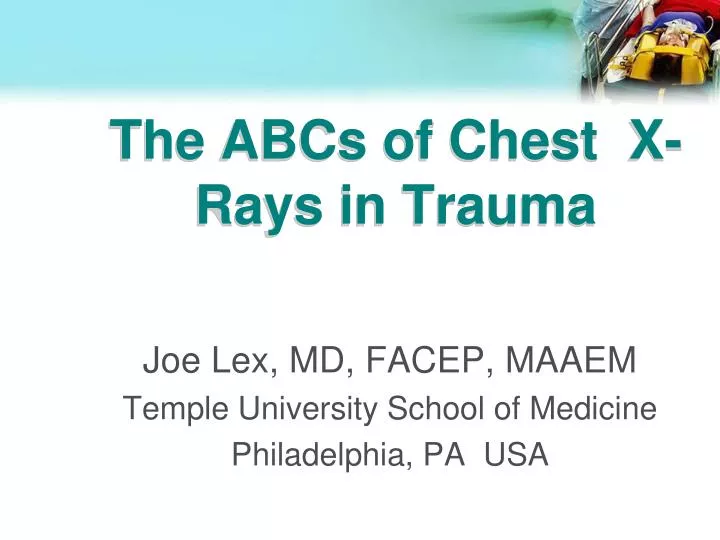 the abcs of chest x rays in trauma