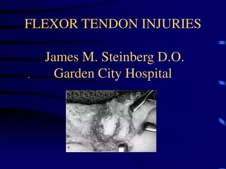 flexor tendon injuries james m steinberg d o garden city hospital