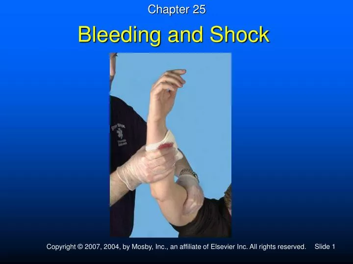 bleeding and shock