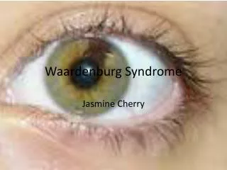 Waardenburg Syndrome