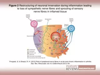 Figure 2 Restructuring of neuronal innervation during inflammation leading to loss of sympathetic nerve fibres and sprou