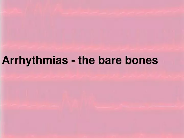 the basics of arrhythmia