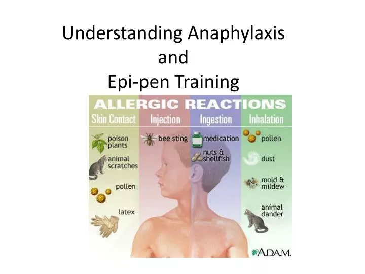 understanding anaphylaxis and epi pen training