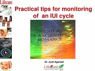 Practical tips for monitoring of an IUI cycle