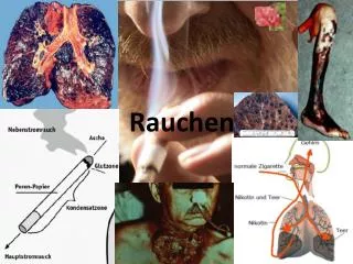 Rauchen