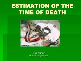 ESTIMATION OF THE TIME OF DEATH