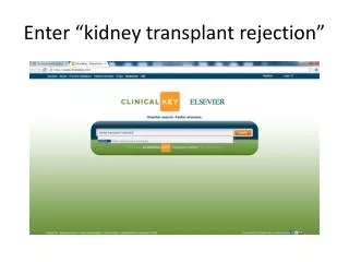 Enter “kidney transplant rejection”