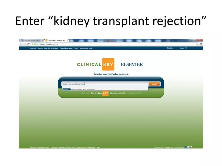 enter kidney transplant rejection