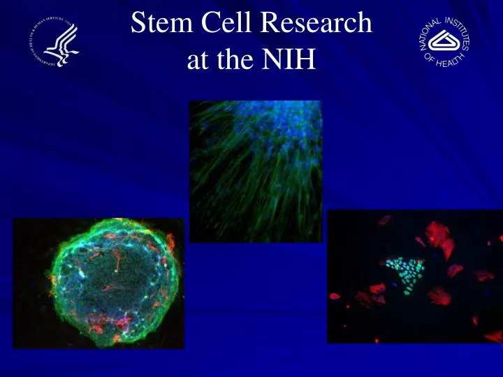 stem cell research at the nih
