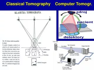 Classical Tomography Computer Tomogr.