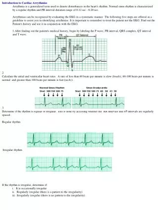 Introduction to Cardiac Arrythmias