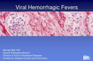 Viral Hemorrhagic Fevers