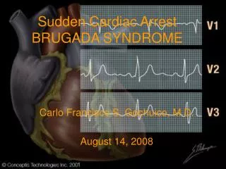 Sudden Cardiac Arrest BRUGADA SYNDROME