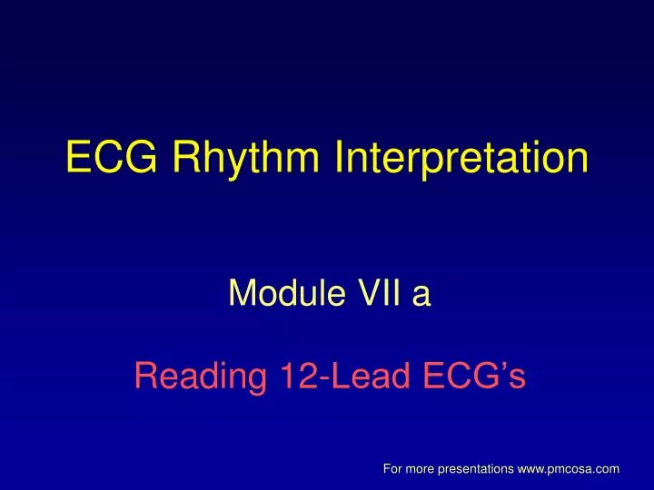 ecg rhythm interpretation