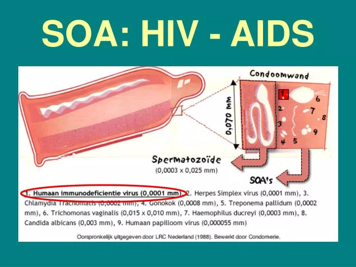 soa hiv aids
