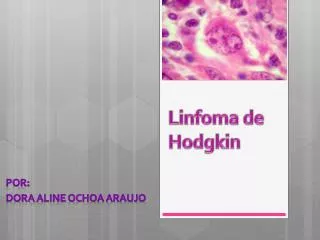 linfoma de hodgkin