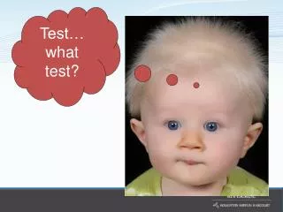 Test… what test?