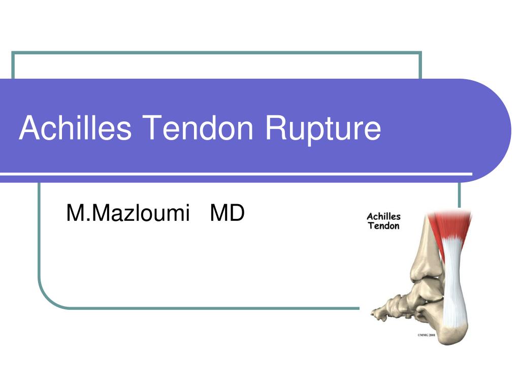 PPT - Achilles Tendon Rupture PowerPoint Presentation, free download ...