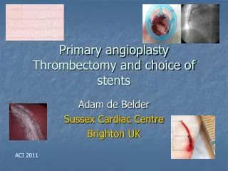 Primary angioplasty Thrombectomy and choice of stents