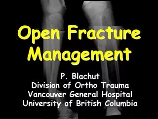 Open Fracture Management
