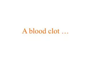 A blood clot …