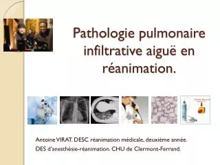 pathologie pulmonaire infiltrative aigu en r animation