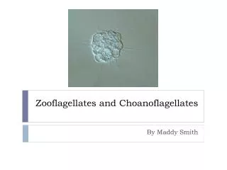 Zooflagellates and Choanoflagellates