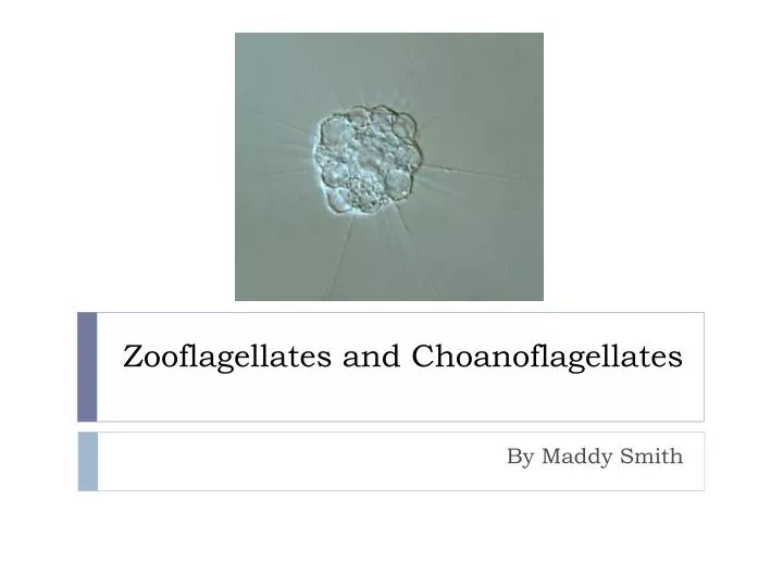 zooflagellates and choanoflagellates