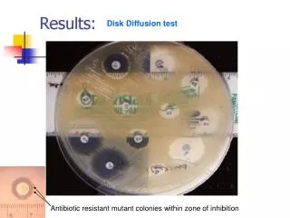 Disk Diffusion test