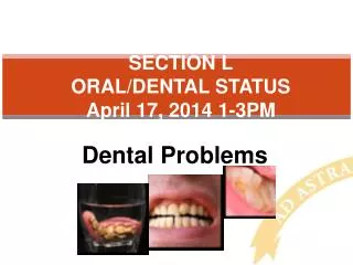 SECTION L ORAL/DENTAL STATUS April 17, 2014 1-3PM