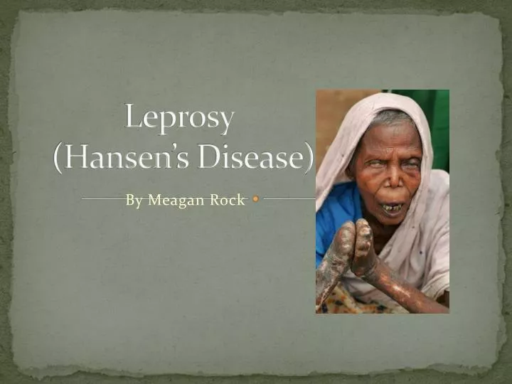 leprosy hansen s disease