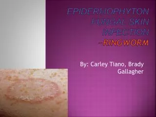 Epidermophyton fungal skin iNfection ~RINGWORM