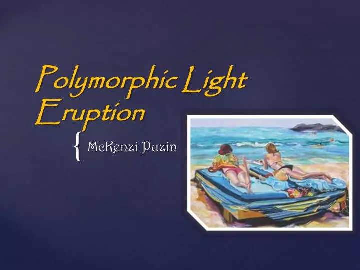polymorphic light eruption