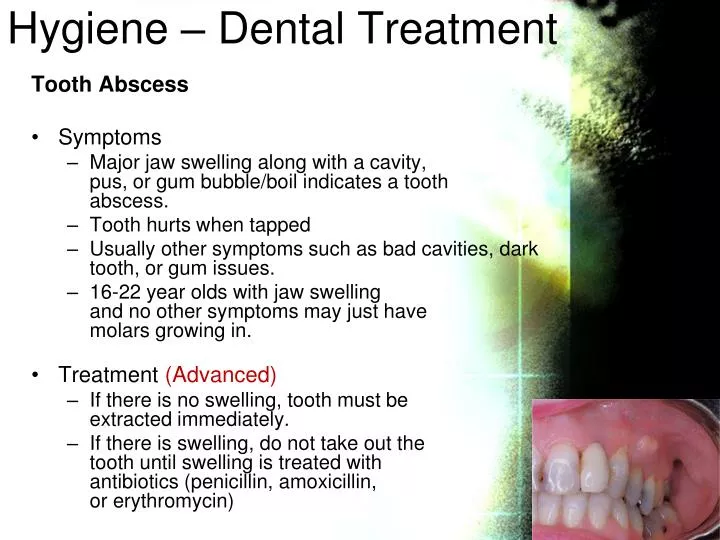 hygiene dental treatment