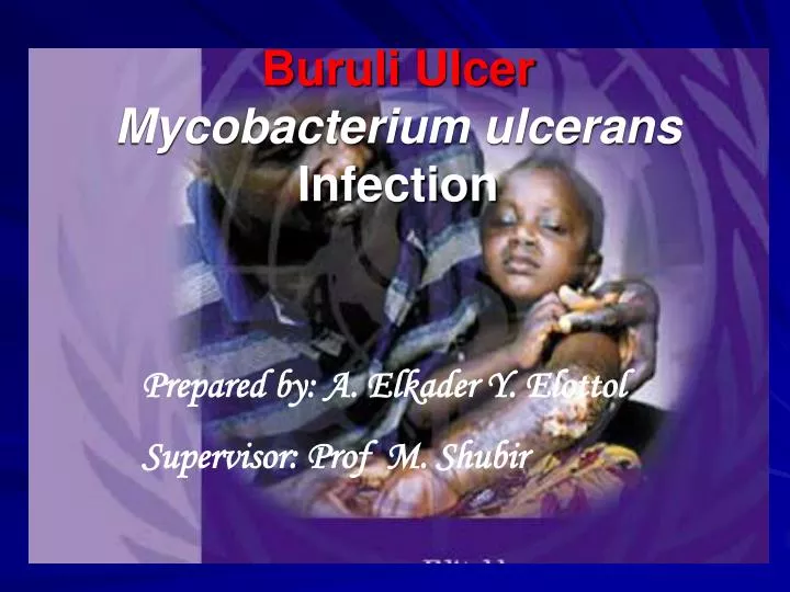 buruli ulcer mycobacterium ulcerans infection