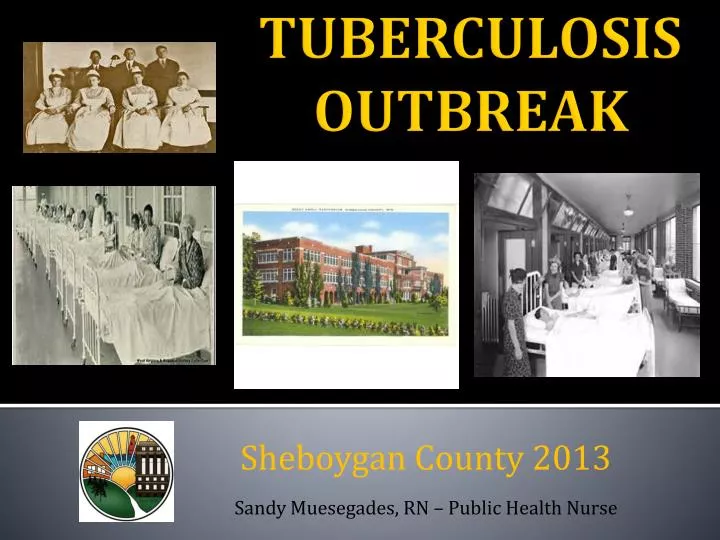 tuberculosis outbreak