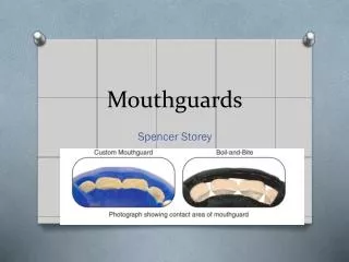 mouthguards