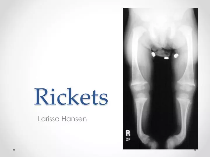 rickets