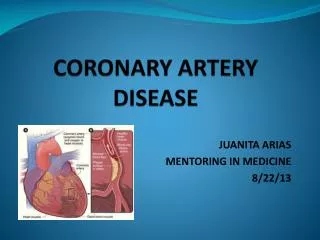 CORONARY ARTERY DISEASE