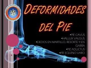 deformidades del pie