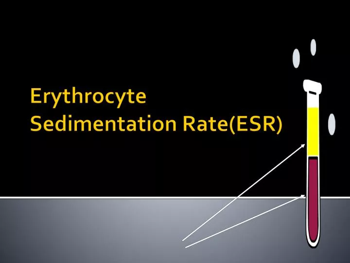 Erythrocyte Sedimentation Rate (ESR)