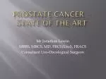 Prostate Cancer - state of the art