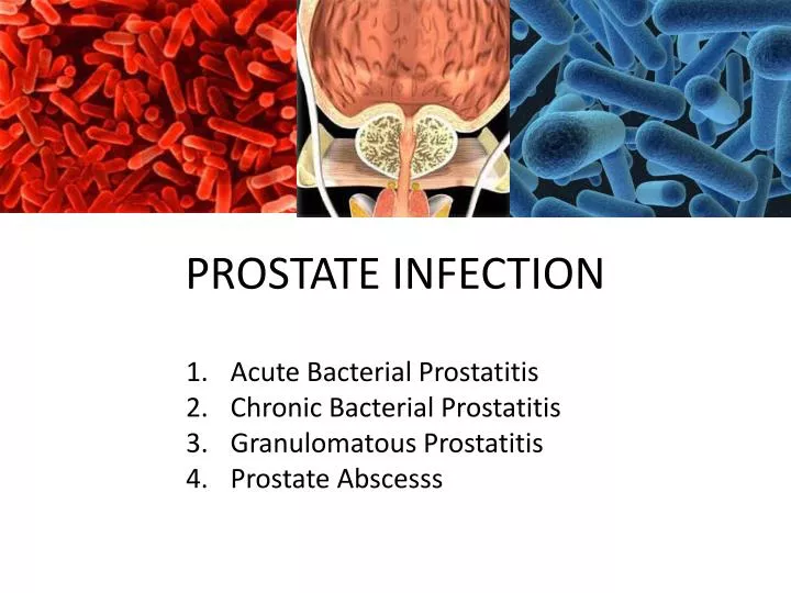 prostate infection