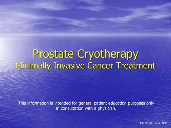 prostate cryotherapy minimally invasive cancer treatment