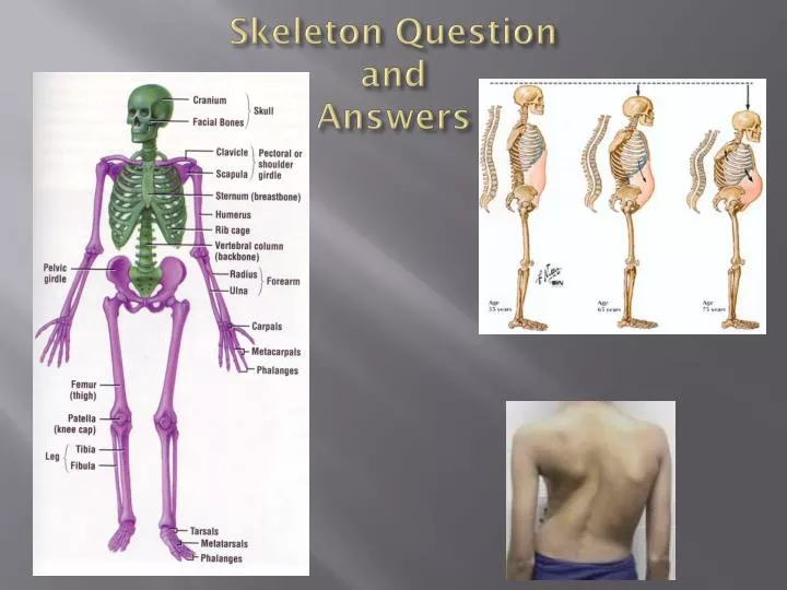 skeleton question and answers