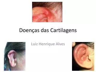 doen as das cartilagens