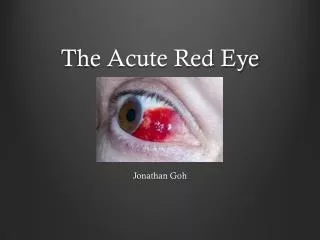 The Acute Red Eye