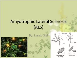 Amyotrophic L ateral Sclerosis (ALS)